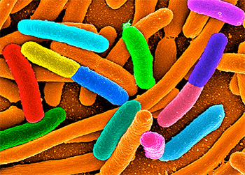 Anna-Synnøve-Nordgard-ecoli-bacteria
